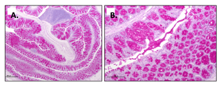 Periodic-Acid-Schiff-PAS-Staining