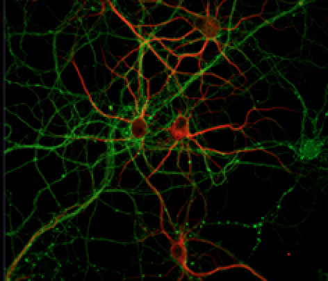 preservedneurons