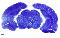 preclinical models of ischemic stroke, pre-clinical CRO, pre clinical research services