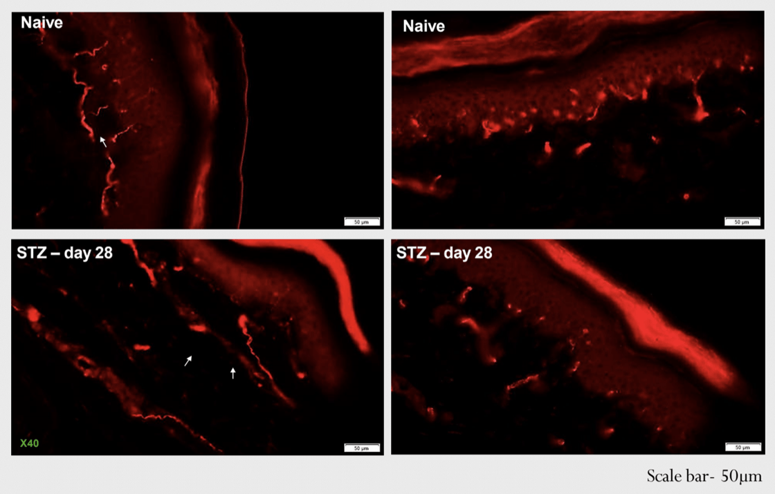 IENF staining_STZ diabetes
