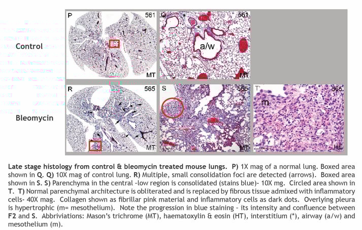 Public_Bleo_Histology_Fig